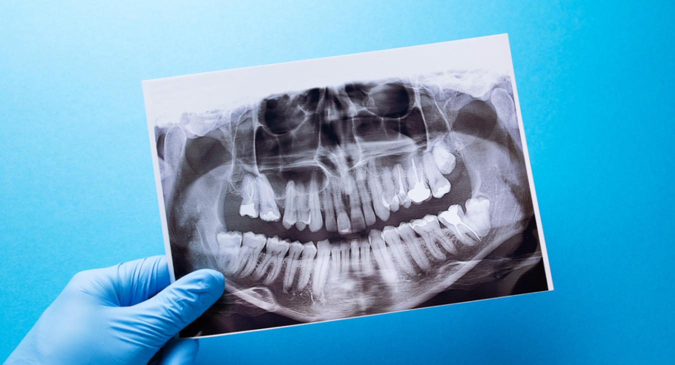 Les spécialistes appellent à introduire en Algérie l’orthodontie médico-légale