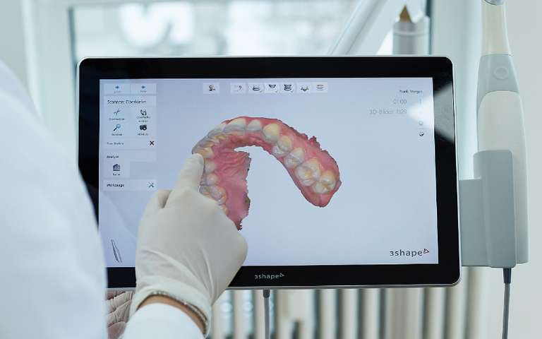 Comment le numérique dans la dentisterie crée des sourires parfaits