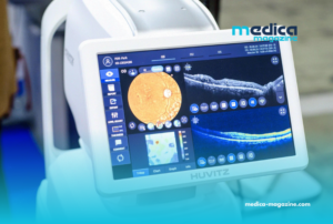 L’IA et l’imagerie OCT : Une révolution pour la cardiologie de précision