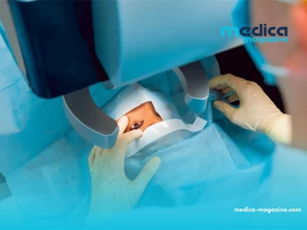 Ophtalmologie : Comment le feedback des patients redessine la chirurgie de l’œil ?