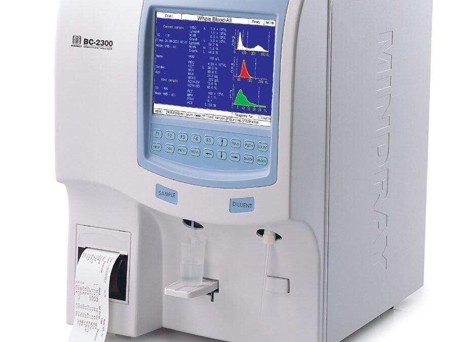 Analyseurs biochimiques automatisés : la révolution silencieuse du diagnostic médical