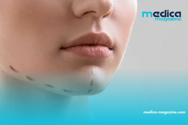 Chirurgie plastique : Des technologies de pointe désormais opérationnelles en Algérie
