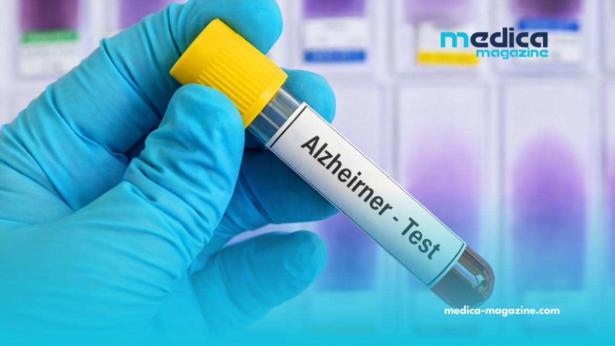 Alzheimer : Comment une simple piqûre au doigt pourrait révolutionner le dépistage précoce