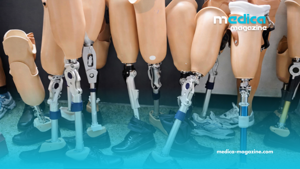 L&rsquo;Algérie mise sur la fabrication locale des prothèses pédiatriques