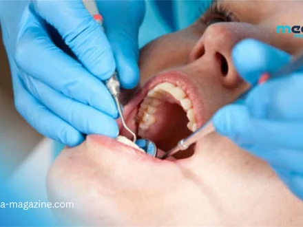 Chirurgie dentaire et cardiopathie : Pourquoi cette collaboration sauve-t-elle des vies ?
