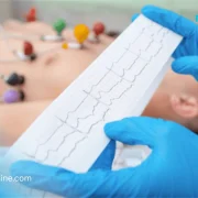 Comment la technologie redessine la cardiologie ambulatoire dans le monde