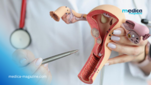 Un col de l&rsquo;utérus artificiel pour combattre les infections sexuellement transmissibles