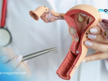 Un col de l&rsquo;utérus artificiel pour combattre les infections sexuellement transmissibles