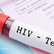VIH en Algérie : Comment la peur et la stigmatisation freinent la lutte contre le Sida