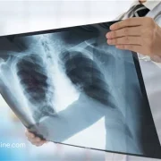 Radiologie : l’intelligence artificielle donne enfin la parole aux images médicales