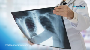 Radiologie : l’intelligence artificielle donne enfin la parole aux images médicales