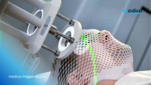 La radiothérapie superficielle révolutionne la prise en charge des cancers cutanés