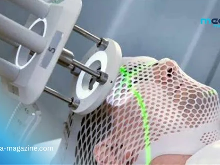 La radiothérapie superficielle révolutionne la prise en charge des cancers cutanés
