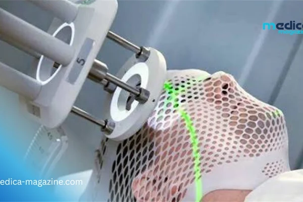 La radiothérapie superficielle révolutionne la prise en charge des cancers cutanés