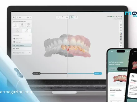 Révolution dentaire : Un nouveau logiciel facilitant le diagnostic des affections bucco-dentaires