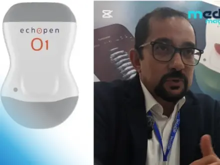 Pr. Iles Sofiane à propos de l&rsquo;échographe portable Echopen : « C&rsquo;est un outil pratique pour agir rapidement » (Vidéo)