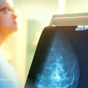Pourquoi le dépistage du cancer du sein en Algérie devient une priorité nationale absolue