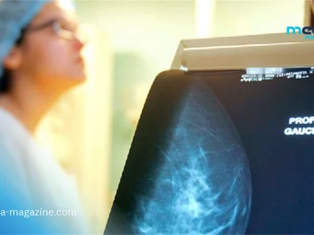 Pourquoi le dépistage du cancer du sein en Algérie devient une priorité nationale absolue